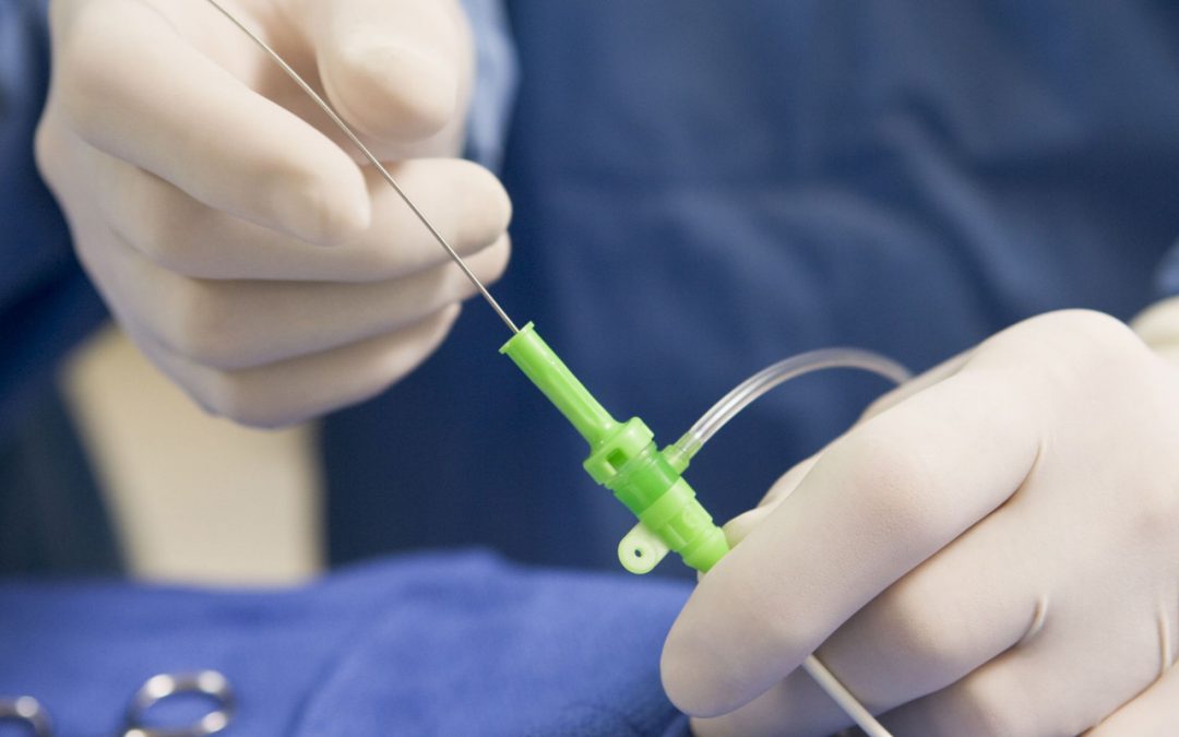 Catheter Market Continues to Grow
